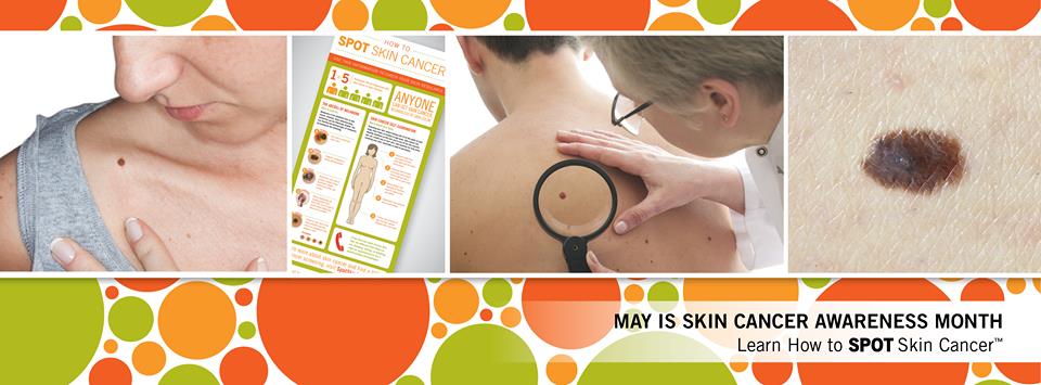 spot-skin-cancer