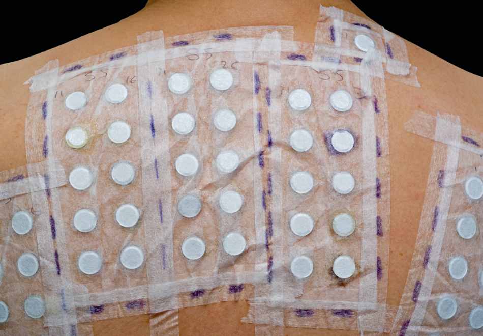 Patch-Test-Jupiter-Dermatology