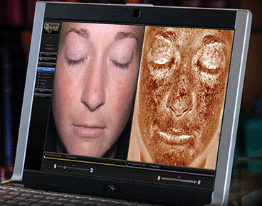facial-analyzer
