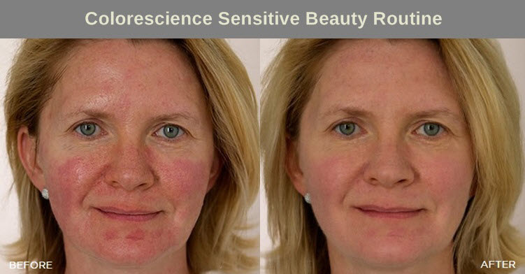 colorescience-before-after-sensitive-beauty-routine