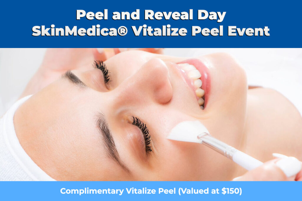 vitalize peel event